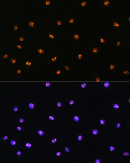 Anti-STK4 Polyclonal Antibody (CAB8043)