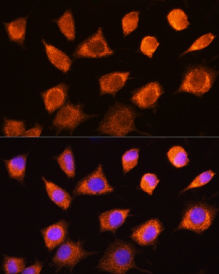 Anti-PKM Antibody (CAB16700)