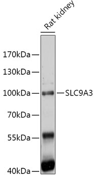 Anti-SLC9A3 Antibody (CAB17532)