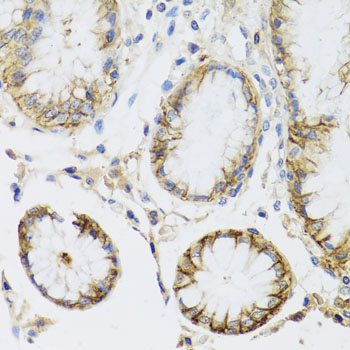 Anti-ATP1A Antibody (CAB0643)