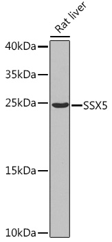 Anti-SSX5 Antibody (CAB7732)