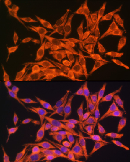 Anti-MT-ATP8 Antibody (CAB17890)