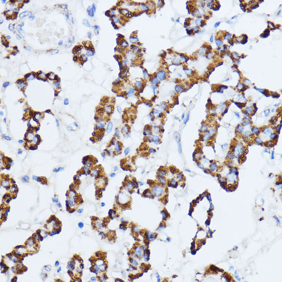 Anti-MAOA Antibody (CAB1354)