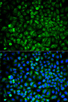 Anti-COMT Antibody (CAB6200)