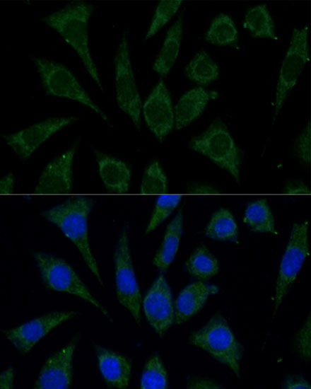 Anti-AKR1C2 Antibody (CAB1048)