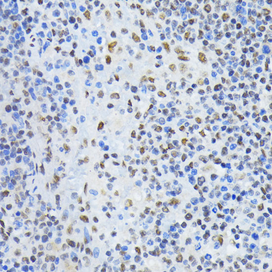 Anti-PTBP1 Antibody (CAB1831)