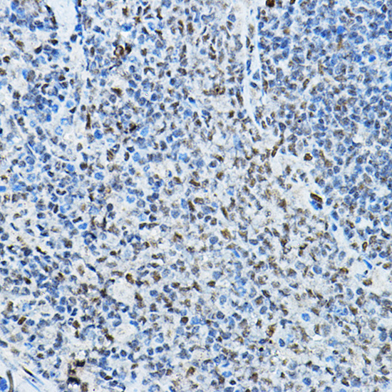 Anti-NCOR2 Polyclonal Antibody (CAB8388)