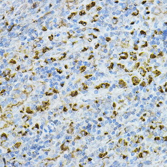 Anti-CTSD Antibody (CAB13292)