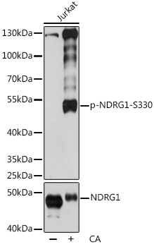 Anti-Phospho-NDRG1-S330 pAb (CABP0807)