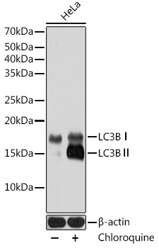 Anti-LC3B Antibody [KO Validated] (CAB19665)