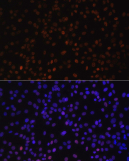 Anti-ZEB2 Antibody (CAB5705)