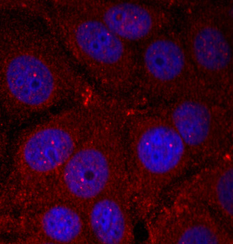 Anti-Phospho-Alpha-synuclein-Y136 Antibody (CABP0254)