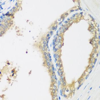 Anti-WDR77 Antibody (CAB7134)