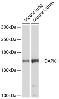 Anti-DAPK1 Antibody (CAB5741)