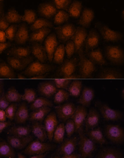 Anti-IPO8 Antibody (CAB14679)