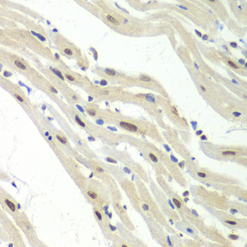 Anti-UPF1 Antibody (CAB13541)