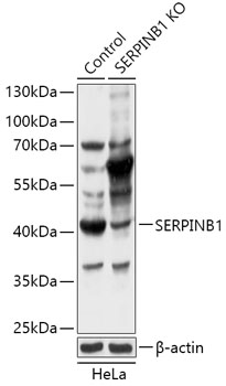 Anti-SERPINB1 Antibody [KO Validated] (CAB18086)