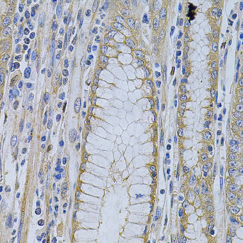 Anti-MVP Antibody (CAB1980)