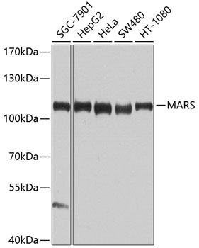 Anti-MARS Polyclonal Antibody (CAB9938)