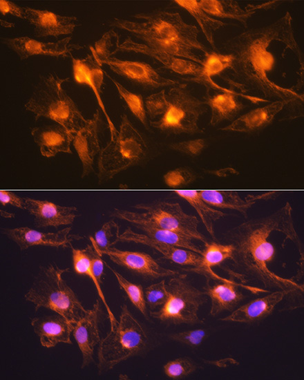 Anti-SYP Antibody (CAB6344)