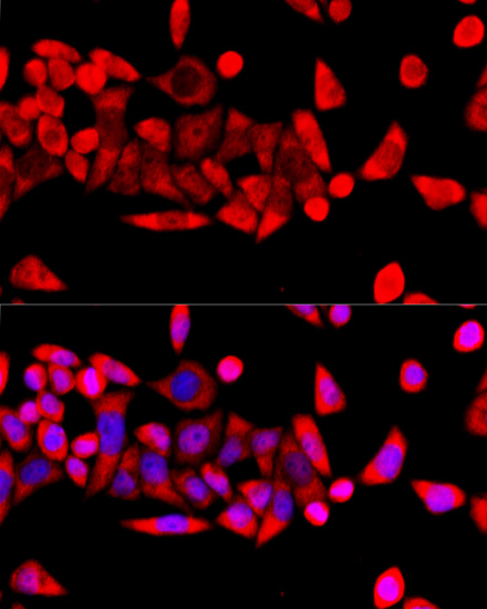 Anti-RPL8 Antibody (CAB10042)