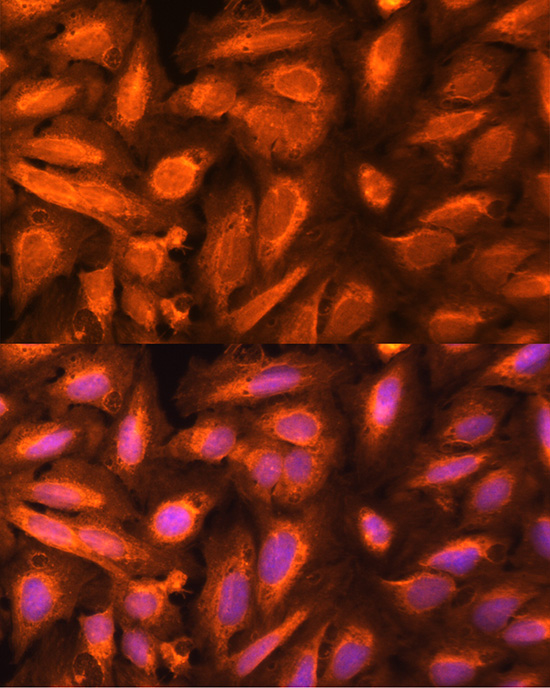 Anti-DTYMK Antibody (CAB6370)