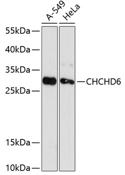 Anti-CHCHD6 Antibody (CAB12911)