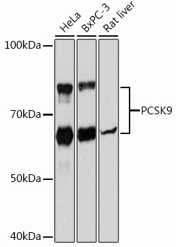 Anti-PCSK9 Antibody