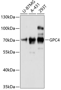 Anti-GPC4 Antibody (CAB12805)