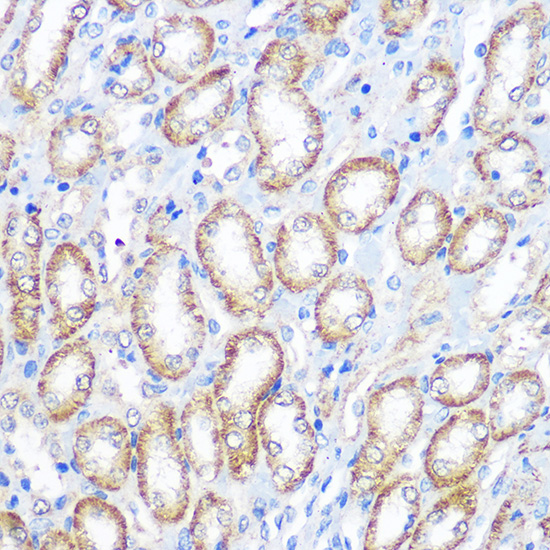 Anti-FCGR1A Antibody (CAB1197)