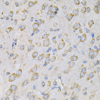 Anti-IL-10RA Antibody (CAB1830)