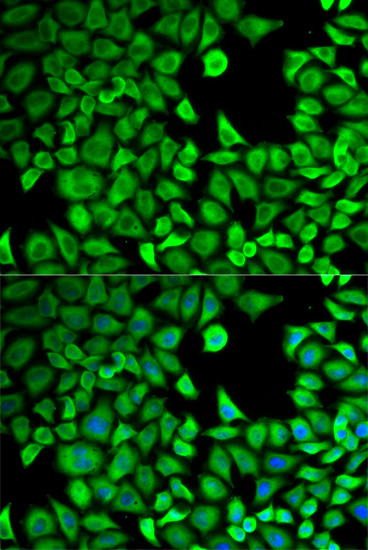 Anti-LTA4H Antibody (CAB2502)