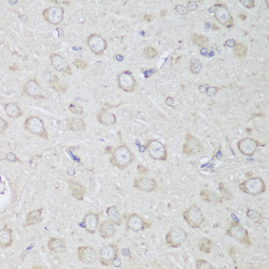 Anti-GANAB Antibody (CAB13851)