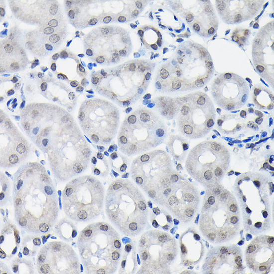 Anti-SSNA1 Antibody (CAB13377)