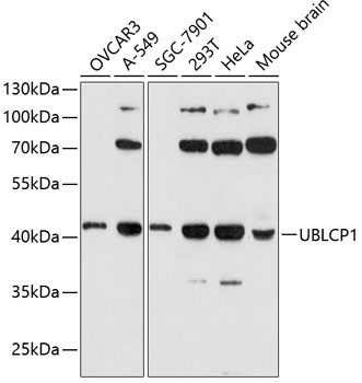Anti-UBLCP1 Antibody (CAB13729)