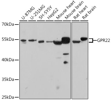 Anti-GPR22 Antibody (CAB18313)