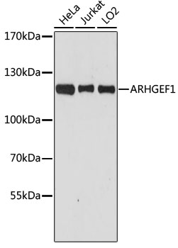 Anti-ARHGEF1 Antibody [KO Validated] (CAB4274)