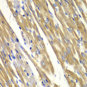 Anti-TYR Antibody (CAB1254)