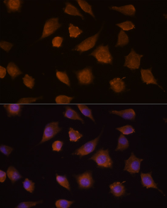 Anti-COMP Antibody (CAB13963)