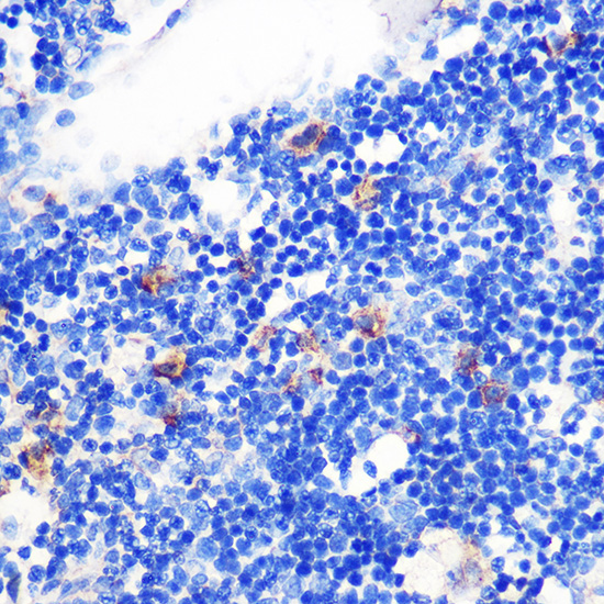 Anti-TGFB1 Antibody (CAB15103)