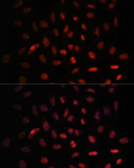 Anti-NXT2 Antibody (CAB13822)