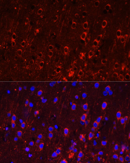 Anti-GRIA1 Antibody (CAB1826)