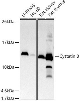 Western blot analysis of extracts of various cell lines, using Cystatin B antibody at 1:500 dilution. Secondary antibody: HRP Goat Anti-Rabbit IgG (H+L) at 1:10000 dilution. Lysates/proteins: 25ug per lane. Blocking buffer: 3% nonfat dry milk in TBST. Detection: ECL Basic Kit. Exposure time: 30s.