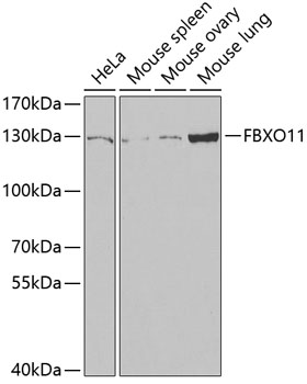 Anti-FBXO11 Antibody (CAB6153)