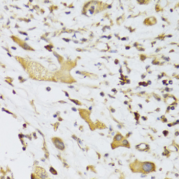 Anti-GPD2 Antibody (CAB6611)