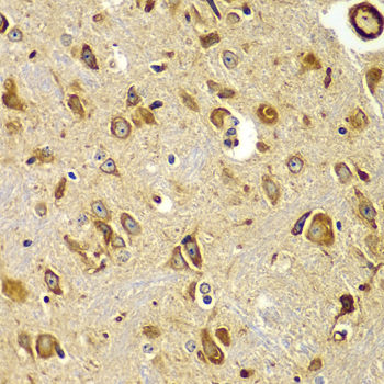 Anti-SMAD9 Antibody (CAB7518)