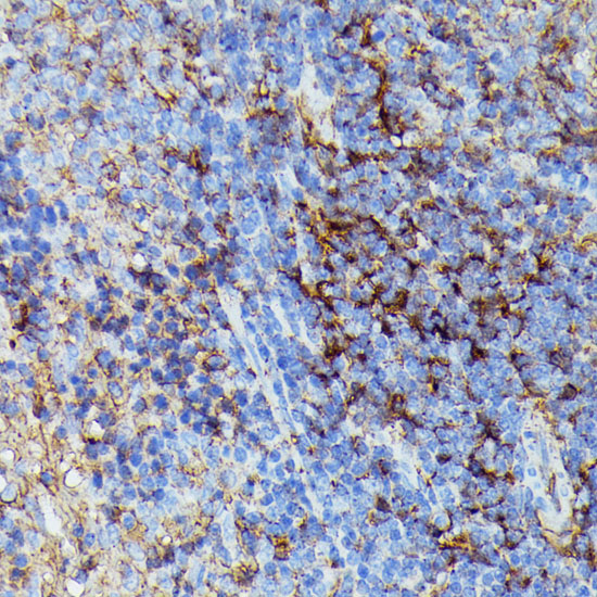 Anti-HLA-B Antibody (CAB1285)