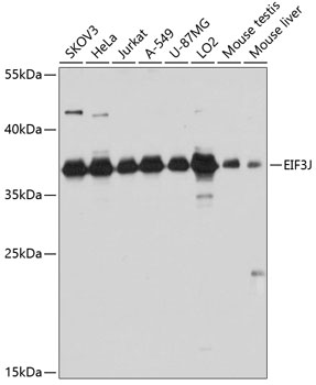 Anti-EIF3J Polyclonal Antibody (CAB8637)