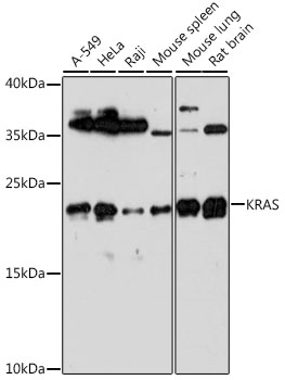 Anti-KRAS Antibody (CAB1190)