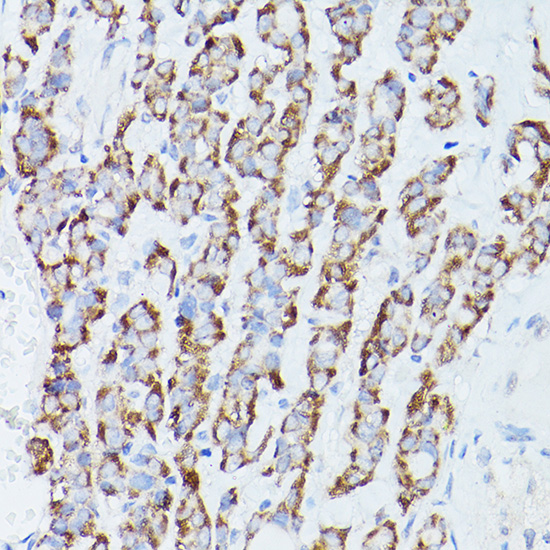 Anti-RPS18 Antibody (CAB11687)